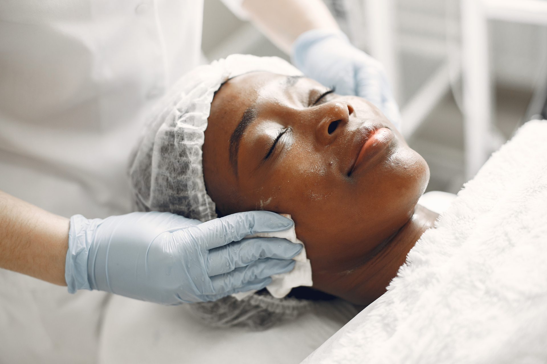 Facial Peels